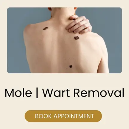 Skin clinic in Siliguri